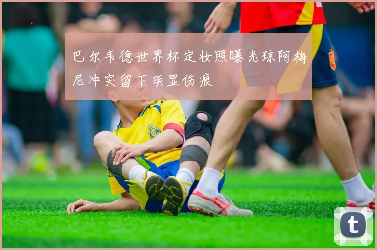巴尔韦德世界杯定妆照曝光琼阿梅尼冲突留下明显伤痕